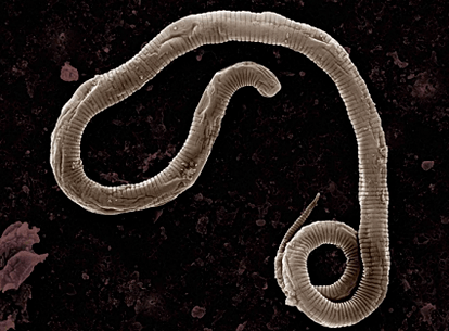 Where do worms come from in the human body