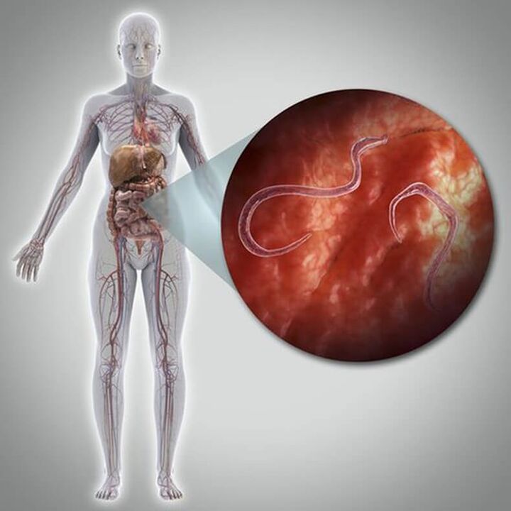 Pests in a person's body