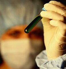 how to test for parasites