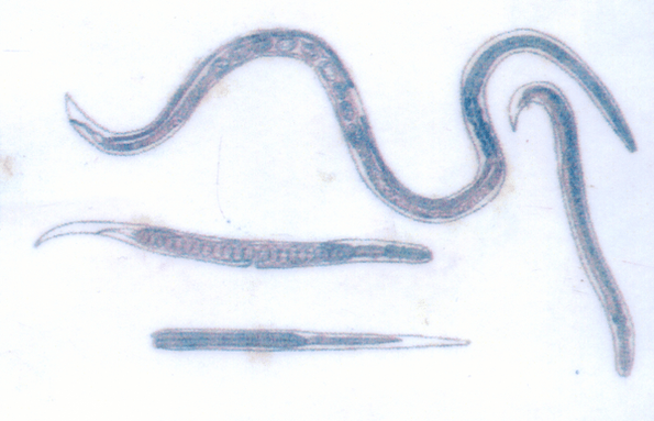 Indian tapeworm, which parasitizes under the skin, is easy to get infected