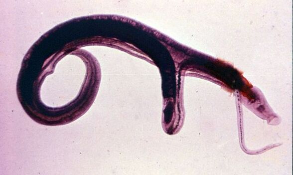Schistosomiasis is one of the most common and dangerous parasites